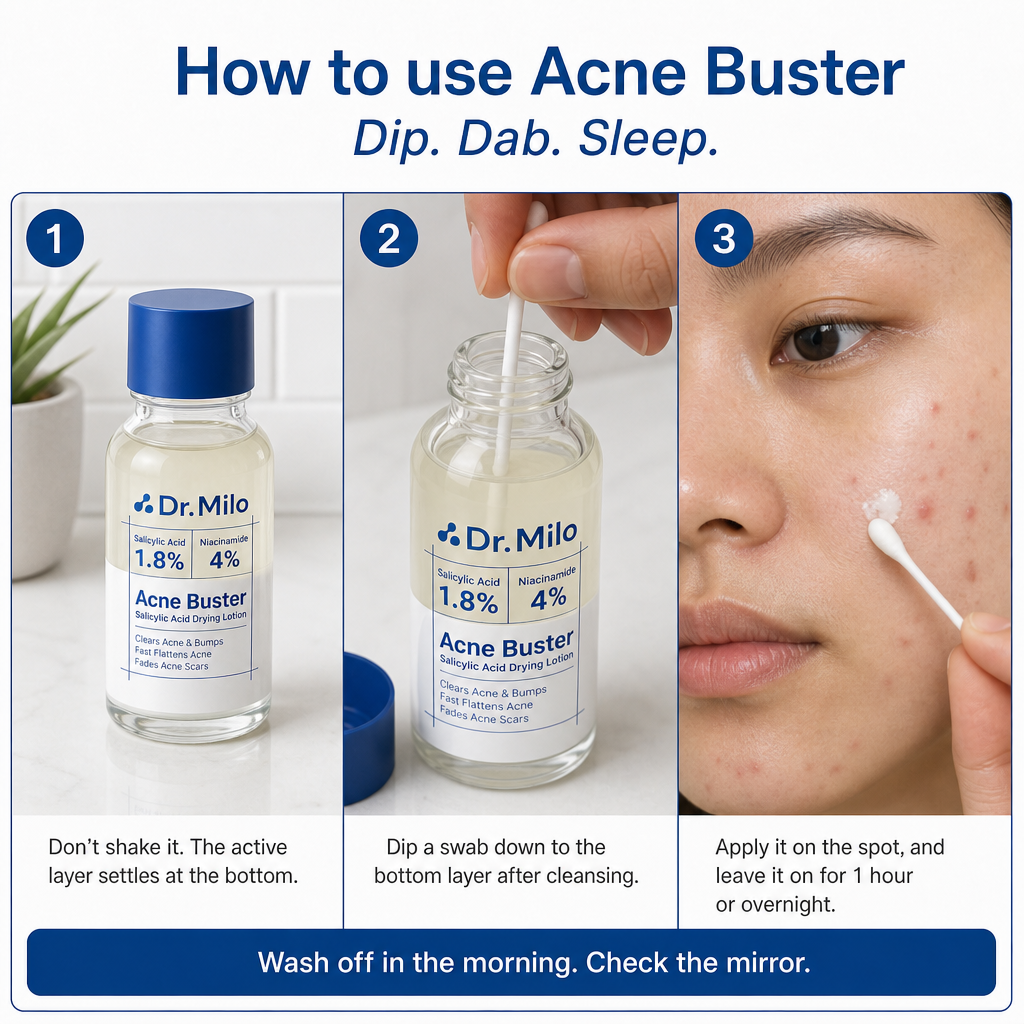 Acne Buster
