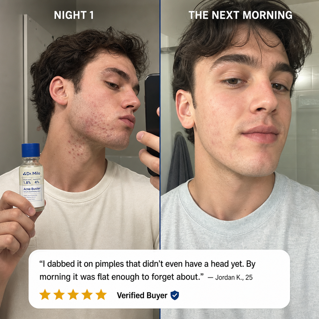 Acne Buster